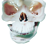 14.png