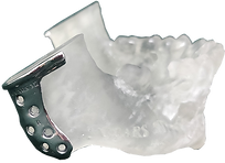 35.png